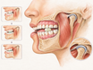 Cross-section of a human jaw in side view shows a piece of sugar-free gum between upper and lower molars, with the masseter muscle and temporomandibular joint highlighted, illustrating how repeated chewing engages the jaw and may contribute to jaw strain.