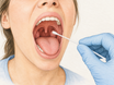 A gloved hand holds a swab near the back of an open mouth and throat during an oral STI test, showing the tongue, tonsils, uvula, and pharynx where infections can be detected.